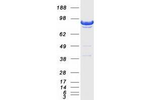 Western Blotting (WB) image for Discs, Large Homolog 3 (DLG3) (Transcript Variant 1) protein (Myc-DYKDDDDK Tag) (ABIN2731386)