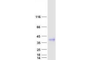 Validation with Western Blot