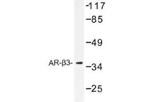 Image no. 1 for anti-Adrenergic, beta-3-, Receptor (ADRB3) antibody (ABIN317855) (ADRB3 抗体)
