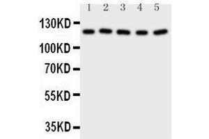 Western Blotting (WB) image for anti-Desmoglein 2 (DSG2) (AA 1104-1118), (C-Term) antibody (ABIN3042669)