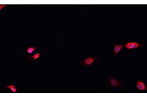 ABIN6266483 staining MCF-7 cells by IF/ICC. (HNRNPD/AUF1 抗体  (Internal Region))