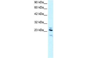 WB Suggested Anti-RGS20 Antibody Titration:  2. (RGS20 抗体  (Middle Region))