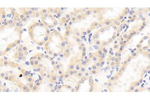 Immunohistochemistry (IHC) image for anti-Angiopoietin-Like 4 (ANGPTL4) (AA 182-394) antibody (ABIN7433021)