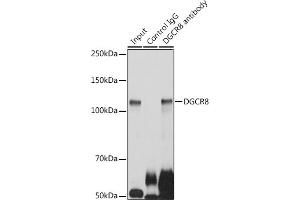 Immunoprecipitation analysis of 300 μg extracts of HeLa cells using 3 μg DGCR8 antibody (ABIN7266761). (DGCR8 抗体)