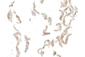 Immunocytochemistry (ICC) image for anti-Syndecan 1 (SDC1) (AA 23-251) antibody (ABIN7795739) (Recombinant Syndecan 1 抗体  (AA 23-251))