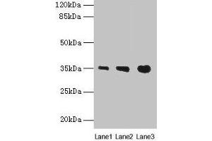 Western blot All lanes: PVRIG antibody at 4 μg/mL Lane 1: Mouse liver tissue Lane 2: Mouse kidney tissue Lane 3: Mouse heart tissue Secondary Goat polyclonal to rabbit IgG at 1/10000 dilution Predicted band size: 35 kDa Observed band size: 35 kDa (PVRIG 抗体  (AA 193-326))