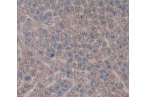 IHC-P analysis of Rat Tissue, with DAB staining. (CA5A 抗体  (AA 12-219))