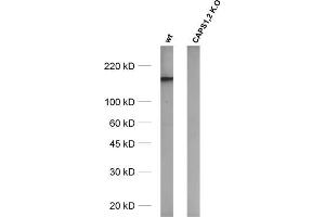 Western Blotting (WB) image for anti-Ca++-Dependent Secretion Activator (CADPS) (AA 18-107) antibody (ABIN1742520) (CADPS 抗体  (AA 18-107))
