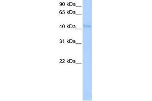 WB Suggested Anti-KLHDC5 Antibody Titration:  0. (KLHDC5 抗体  (N-Term))