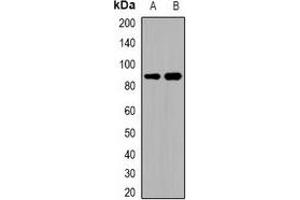 Western blot analysis of ADAM32 expression in HEK293T (A), human testis (B) whole cell lysates. (ADAM32 抗体)