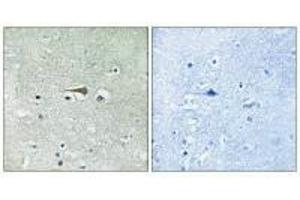 Immunohistochemistry analysis of paraffin-embedded human brain tissue using TTK (Ab-676) antibody. (Mps1 抗体  (Thr676))