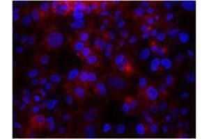 Immunofluorescence (IF) image for anti-Integrin beta 3 (ITGB3) antibody (ABIN2664787) (Integrin beta 3 抗体)