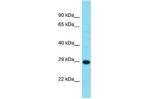 Western Blotting (WB) image for anti-Haloacid Dehalogenase-Like Hydrolase Domain Containing 3 (HDHD3) (C-Term) antibody (ABIN2791573) (HDHD3 抗体  (C-Term))