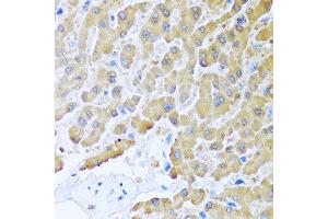 Immunohistochemistry of paraffin-embedded human liver using CCL8 antibody at dilution of 1:100 (40x lens). (CCL8 抗体)