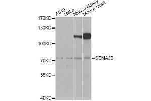 Western blot analysis of extracts of various cell lines, using SEMA3B Antibody. (SEMA3B 抗体)