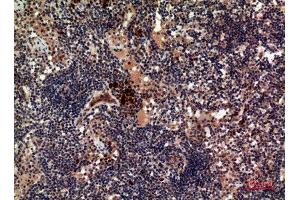 Immunohistochemistry (IHC) image for anti-Tumor Necrosis Factor (Ligand) Superfamily, Member 11 (TNFSF11) (C-Term) antibody (ABIN3187907)