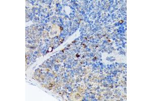 Immunohistochemistry of paraffin-embedded mouse spleen using C Rabbit mAb (ABIN7266125) at dilution of 1:100 (40x lens).