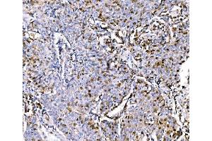 IHC analysis of Geminin/GMNN using anti-Geminin/GMNN antibody (ABIN7600598). (Geminin 抗体  (AA 21-196))
