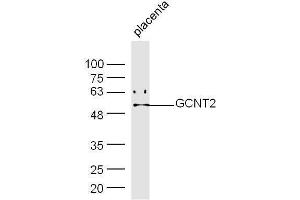 Mouse placenta lysates probed with Rabbit Anti-GCNT Polyclonal Antibody, Unconjugated  at 1:500 for 90 min at 37˚C. (GCNT2 抗体  (AA 151-250))