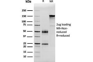 SDS-PAGE Analysis Purified PSA Mouse Monoclonal Antibody (APCS/3240). (APCS 抗体  (AA 143-223))