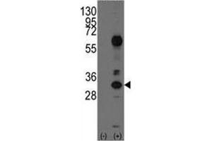 Western blot analysis of CD8A antibody and 293 cell lysate (2 ug/lane) either nontransfected (Lane 1) or transiently transfected with the CD8A gene (2). (CD8 alpha 抗体  (AA 59-88))