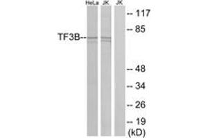 Western blot analysis of extracts from HeLa/Jurkat cells, using TF3B Antibody. (BRF1 抗体  (AA 231-280))