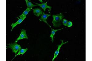 Immunofluorescent analysis of MCF-7 cells using ABIN7142512 at dilution of 1:100 and Alexa Fluor 488-congugated AffiniPure Goat Anti-Rabbit IgG(H+L) (RPS2 抗体  (AA 2-61))
