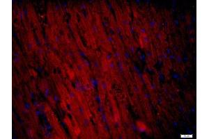 Paraformaldehyde-fixed, paraffin embedded Mouse heart tissue, Antigen retrieval by boiling in sodium citrate buffer(pH6) for 15min, Block endogenous peroxidase by 3% hydrogen peroxide for 20 minutes, Blocking buffer (normal goat serum) at 37°C for 30min, Antibody incubation with RNF169 Polyclonal Antibody, Unconjugated  at 1:400 overnight at 4°C, followed by a conjugated secondary and DAPI staining (RNF169 抗体)