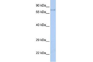 WB Suggested Anti-IGF1R Antibody Titration:  0. (IGF1R 抗体  (Middle Region))