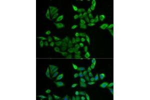Immunofluorescence analysis of U2OS cells using PNP Polyclonal Antibody (PNP 抗体)