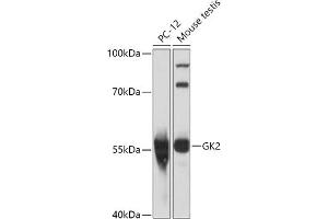 Western blot analysis of extracts of various cell lines, using GK2 antibody (ABIN7267458) at 1:1000 dilution. (GK2 抗体  (AA 1-150))