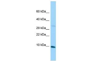 Host: Rabbit Target Name: MRPL36 Sample Type: Jurkat Whole Cell lysates Antibody Dilution: 1.