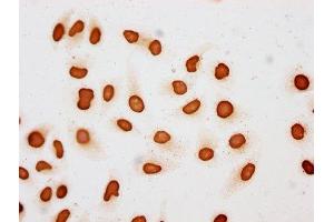 Immunocytochemistry analysis of ABIN7139175 diluted at 1:10 and staining in Hela cells (treated with 30mM sodium butyrate for 4h) performed on a Leica BondTM system.