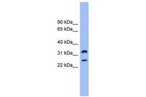 Image no. 1 for anti-Fc Fragment of IgE Receptor Ia (FCER1A) (AA 35-84) antibody (ABIN6744794) (Fc epsilon RI/FCER1A 抗体  (AA 35-84))
