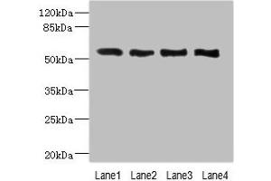 Western blot All lanes: VANGL2 antibody at 2.