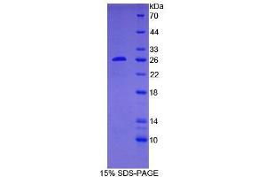 SDS-PAGE of Protein Standard from the Kit (Highly purified E. (Bcl-2 CLIA Kit)