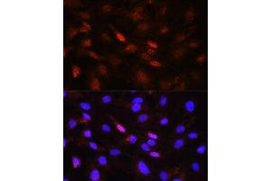 Immunofluorescence analysis of NIH/3T3 cells using Phospho-Jak1-Y1022/1023 antibody (ABIN6135246, ABIN6136118, ABIN6136119 and ABIN6225560) at dilution of 1:100. (JAK1 抗体  (pTyr1022, pTyr1023))
