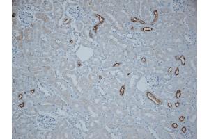Immunohistochemistry (IHC) image for anti-Solute Carrier Family 12 (Sodium/Chloride Transporters), Member 3 (SLC12A3) (AA 74-95) antibody (APC) (ABIN2486291)