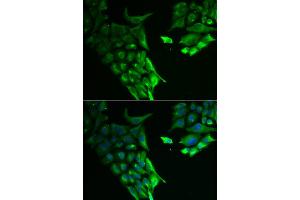 Immunofluorescence analysis of A549 cell using HABP2 antibody. (HABP2 抗体)