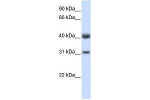PDSS2 antibody used at 1 ug/ml to detect target protein. (PDSS2 抗体)
