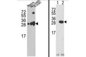 (LEFT) Western blot analysis of UCHL1 Antibody (C-term) in Ramos, NCI-H460 cell line and mouse brain tissue lysates (35ug/lane).