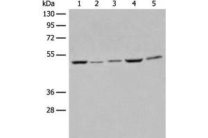 Western blot analysis of Raji Hela A549 HEPG2 and 231 cell lysates using EIF4A3 Polyclonal Antibody at dilution of 1:500 (EIF4A3 抗体)