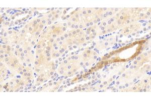 Detection of MMP13 in Human Kidney Tissue using Polyclonal Antibody to Matrix Metalloproteinase 13 (MMP13) (MMP13 抗体  (AA 290-468))
