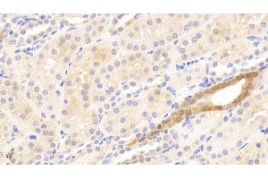 Detection of MMP13 in Human Kidney Tissue using Polyclonal Antibody to Matrix Metalloproteinase 13 (MMP13)