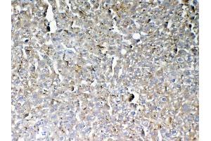 Immunohistochemistry (IHC) image for anti-Galactosamine (N-Acetyl)-6-Sulfate Sulfatase (GALNS) (AA 181-289) antibody (ABIN5693230)