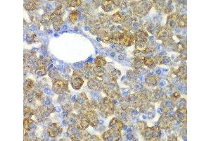 Immunohistochemistry of paraffin-embedded Mouse liver using FAH Polyclonal Antibody at dilution of 1:100 (40x lens). (FAH 抗体)