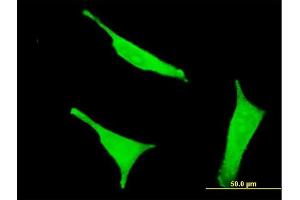 Immunofluorescence of monoclonal antibody to CD38 on HeLa cell. (CD38 抗体  (AA 201-300))