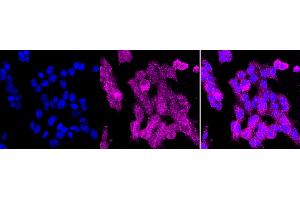 Immunocytochemical staining of HAP-1 cells with NFATC2 antibody (ABIN7799637), 1:1,000).