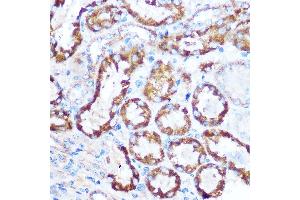 Immunohistochemistry of paraffin-embedded mouse kidney using M Rabbit pAb (ABIN6130539, ABIN6143505, ABIN6143506 and ABIN6221614) at dilution of 1:100 (40x lens). (MAP4 抗体  (AA 942-1152))