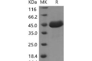 Western Blotting (WB) image for SPARC-Like 1 (Hevin) (SPARCL1) protein (His tag) (ABIN7320238) (SPARCL1 Protein (His tag))